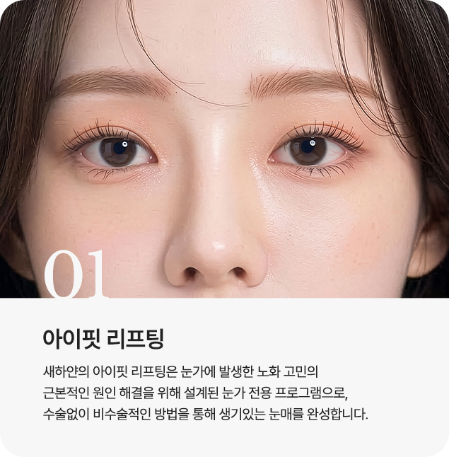 아이핏 리프팅