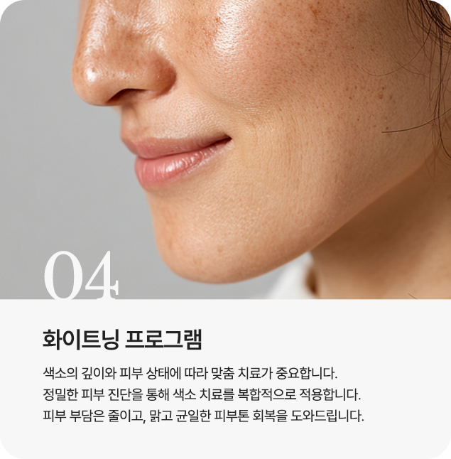 화이트닝 프로그램