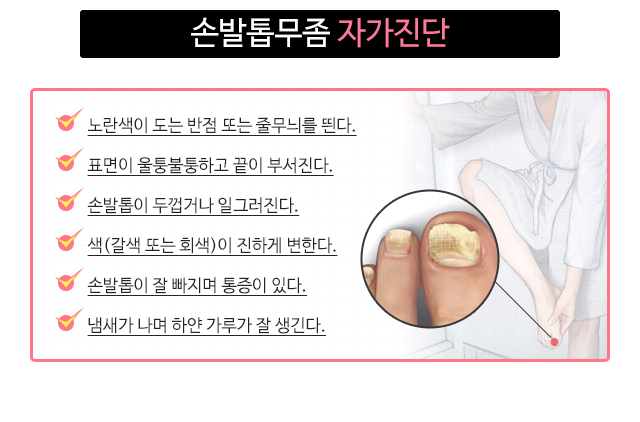 손발톱무좀 자가진단