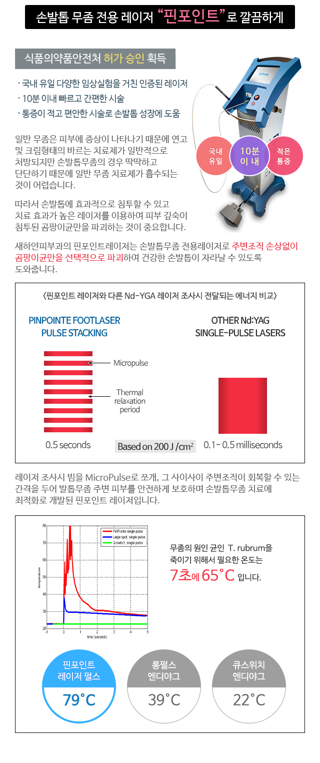 손발톱 무좀 전용 레이저 “핀포인트”로 깔끔하게