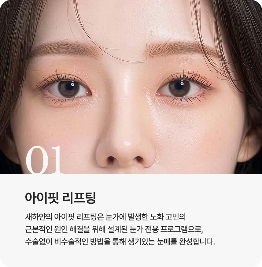 아이핏 리프팅