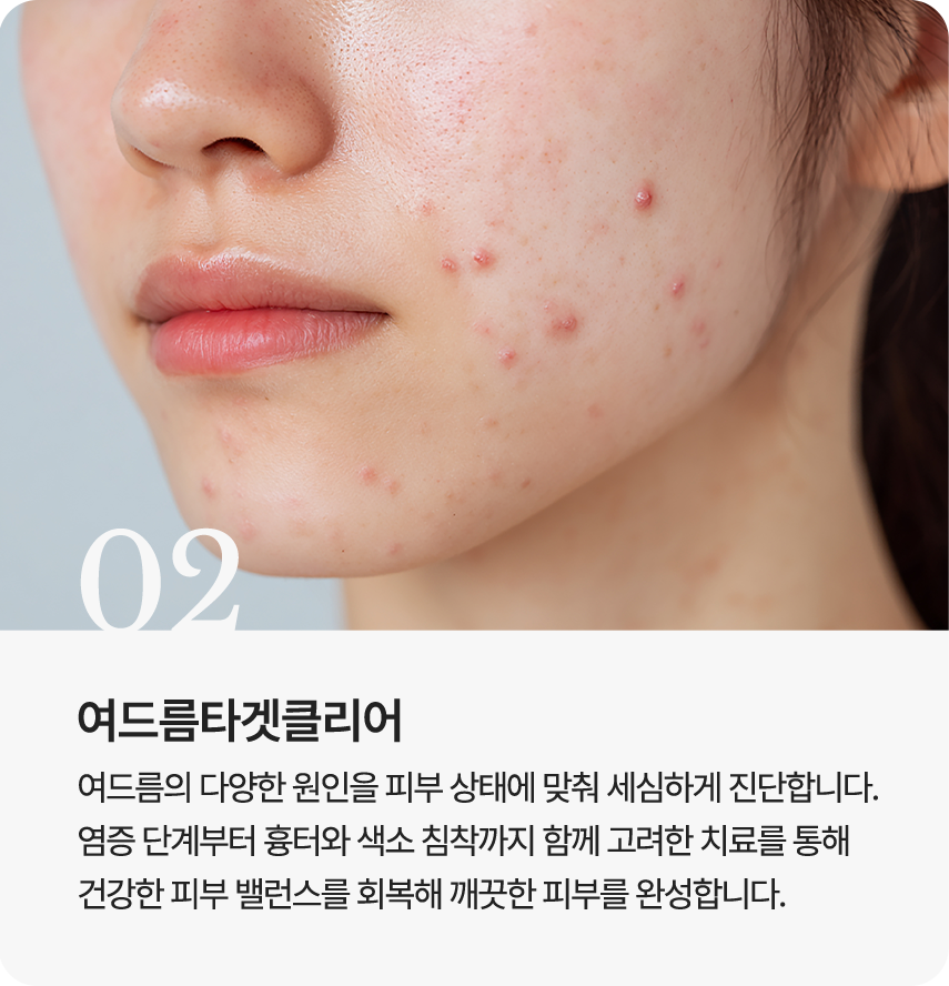 여드름타겟클리어