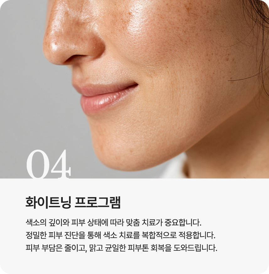 화이트닝 프로그램
